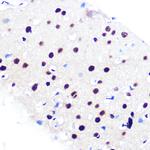 RbAp48 Antibody in Immunohistochemistry (Paraffin) (IHC (P))