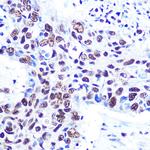 RbAp48 Antibody in Immunohistochemistry (Paraffin) (IHC (P))