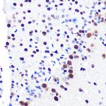 RbAp48 Antibody in Immunohistochemistry (Paraffin) (IHC (P))