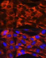 RPS19 Antibody in Immunocytochemistry (ICC/IF)