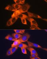 RPS19 Antibody in Immunocytochemistry (ICC/IF)