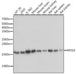 RPS19 Antibody in Western Blot (WB)