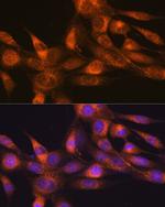 RHEB Antibody in Immunocytochemistry (ICC/IF)