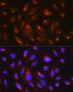 RHEB Antibody in Immunocytochemistry (ICC/IF)