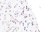 PUMA alpha Antibody in Immunohistochemistry (Paraffin) (IHC (P))