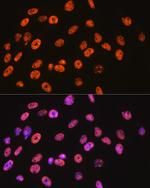 NONO Antibody in Immunocytochemistry (ICC/IF)