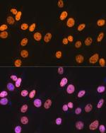 NONO Antibody in Immunocytochemistry (ICC/IF)