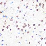 NONO Antibody in Immunohistochemistry (Paraffin) (IHC (P))