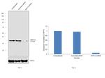 AKR1C3 Antibody