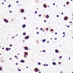 SAM68 Antibody in Immunohistochemistry (Paraffin) (IHC (P))