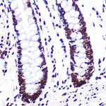 SAM68 Antibody in Immunohistochemistry (Paraffin) (IHC (P))