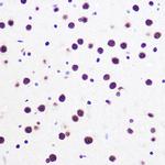 SAM68 Antibody in Immunohistochemistry (Paraffin) (IHC (P))