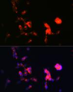 DKK3 Antibody in Immunocytochemistry (ICC/IF)