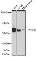 PFKFB3 Antibody in Western Blot (WB)