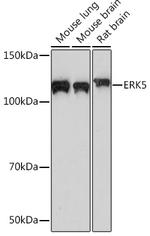 ERK5 Antibody in Western Blot (WB)