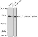 Nogo Receptor Antibody in Western Blot (WB)