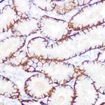 NDRG1 Antibody in Immunohistochemistry (Paraffin) (IHC (P))