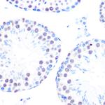 Cyclin H Antibody in Immunohistochemistry (Paraffin) (IHC (P))