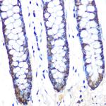 JAB1 Antibody in Immunohistochemistry (Paraffin) (IHC (P))