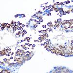 JAB1 Antibody in Immunohistochemistry (Paraffin) (IHC (P))