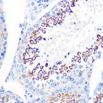 CD59 Antibody in Immunohistochemistry (Paraffin) (IHC (P))