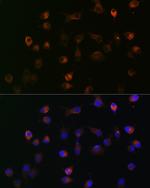 gamma Catenin Antibody in Immunocytochemistry (ICC/IF)