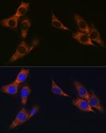 gamma Catenin Antibody in Immunocytochemistry (ICC/IF)