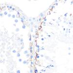 gamma Catenin Antibody in Immunohistochemistry (Paraffin) (IHC (P))