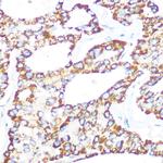 gamma Catenin Antibody in Immunohistochemistry (Paraffin) (IHC (P))