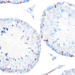 gamma Catenin Antibody in Immunohistochemistry (Paraffin) (IHC (P))