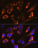 SFRP4 Antibody in Immunocytochemistry (ICC/IF)