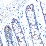 SFRP4 Antibody in Immunohistochemistry (Paraffin) (IHC (P))