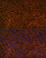 CPS1 Antibody in Immunohistochemistry (Paraffin) (IHC (P))