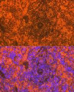 CD83 Antibody in Immunohistochemistry (Paraffin) (IHC (P))