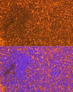 CD83 Antibody in Immunohistochemistry (Paraffin) (IHC (P))