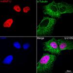 hnRNP U Antibody in Immunocytochemistry (ICC/IF)