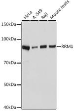 RRM1 Antibody in Western Blot (WB)