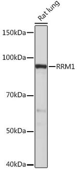 RRM1 Antibody in Western Blot (WB)