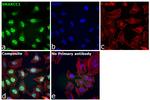 SMARCC1 Antibody in Immunocytochemistry (ICC/IF)