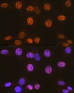 SMARCC1 Antibody in Immunocytochemistry (ICC/IF)