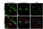 SMARCC1 Antibody in Immunocytochemistry (ICC/IF)