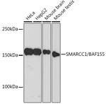 SMARCC1 Antibody in Western Blot (WB)