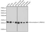 PRDX2 Antibody in Western Blot (WB)