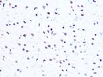 HMGA1 Antibody in Immunohistochemistry (Paraffin) (IHC (P))