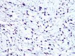 HMGA1 Antibody in Immunohistochemistry (Paraffin) (IHC (P))