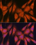 Laminin beta-1 Antibody in Immunocytochemistry (ICC/IF)