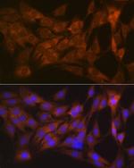 Tetranectin Antibody in Immunocytochemistry (ICC/IF)