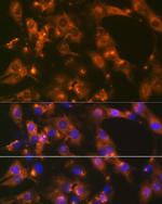 alpha Adaptin Antibody in Immunocytochemistry (ICC/IF)