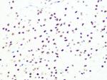 DKC1 Antibody in Immunohistochemistry (Paraffin) (IHC (P))