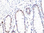 DKC1 Antibody in Immunohistochemistry (Paraffin) (IHC (P))